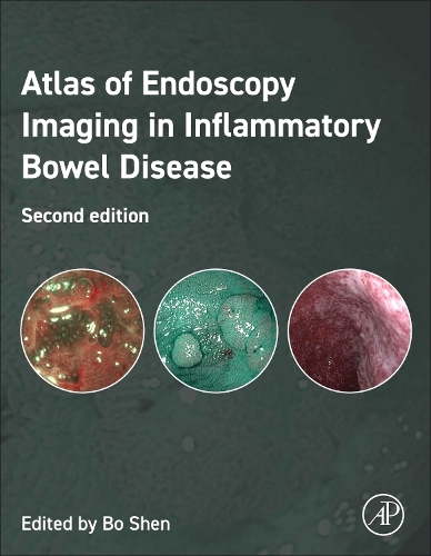 Бумажная книга «Atlas of Endoscopy Imaging in Inflammatory Bowel Disease», автор Бо Шэнь - фото №1