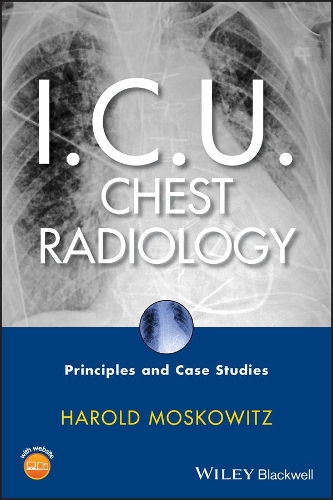 Паперова книга «I.C.U. Chest Radiology: Principles and Case Studies», автор Гарольд Московіц - фото №1