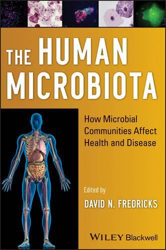 Паперова книга «The Human Microbiota: How Microbial Communities Affect Health and Disease», автор Девід Н. Фредрікс - фото №1