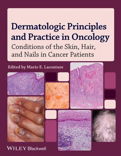 Бумажная книга «Dermatologic Principles and Practice in Oncology: Conditions of the Skin, Hair, and Nails in Cancer Patients», автор Марио Э. Лакутюр - фото №1