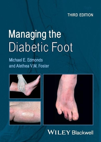 Паперова книга «Managing the Diabetic Foot», авторів Алетея В.М. Фостер, Майкл Е. Едмондс - фото №1