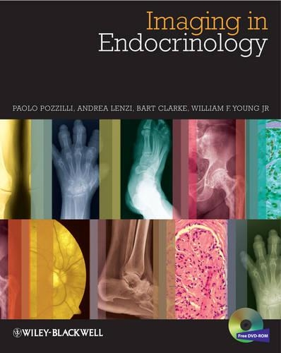 Паперова книга «Imaging in Endocrinology», авторів Андреа Ленці, Барт Л. Кларк, Паоло Поцціллі, Вільям Ф. Янг - фото №1
