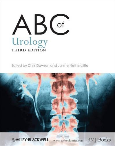Бумажная книга «ABC of Urology», авторов Крис Доусон, Джанин Незерклифф - фото №1