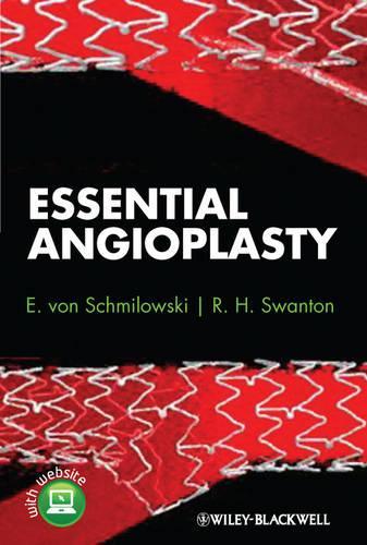 Бумажная книга «Essential Angioplasty», авторов Э. von Schmilowski, Р. Х. Суонтон - фото №1