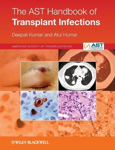Бумажная книга «The AST Handbook of Transplant Infections», авторов Атул Хумар, Дипали Кумар - фото №1