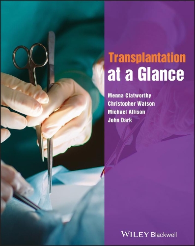 Бумажная книга «Transplantation at a Glance», авторов Кристофер Уотсон, Джон Дарк, Менна Клатворти, Майкл Эллисон - фото №1