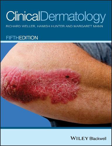 Паперова книга «Clinical Dermatology», авторів Гаміш Дж. А. Хантер, Маргарет В. Манн, Річард Б. Веллер - фото №1