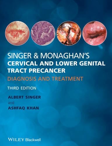 Паперова книга «Singer and Monaghan's Cervical and Lower Genital Tract Precancer: Diagnosis and Treatment», авторів Альберт Зінгер, Ашфак Хан - фото №1