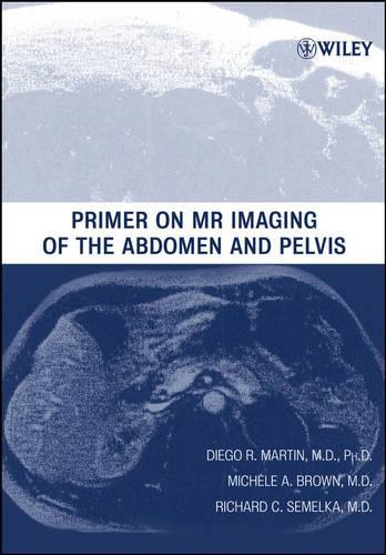 Паперова книга «Primer on MR Imaging of the Abdomen and Pelvis», авторів Дієго Р. Мартін, Мішель А. Браун, Річард К. Семелка - фото №1
