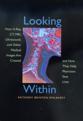 Бумажная книга «Looking Within: How X-Ray, CT, MRI, Ultrasound, and Other Medical Images Are Created, and How They Help Physicians Save Lives», автор Энтони Бринтон Вулбарст - фото №1
