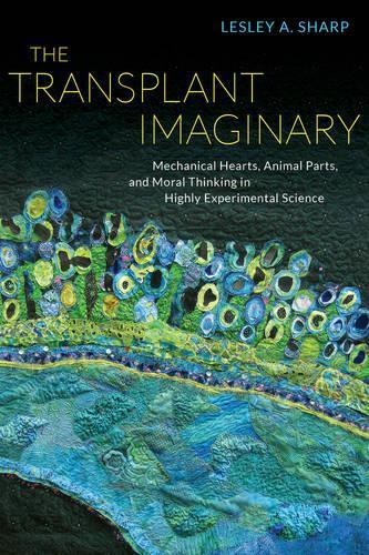 Паперова книга «The Transplant Imaginary: Mechanical Hearts, Animal Parts, and Moral Thinking in Highly Experimental Science», автор Леслі А. Шарп - фото №1
