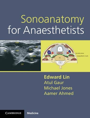 Паперова книга «Sonoanatomy for Anaesthetists», авторів Аамер Ахмед, Атул Гаур, Едвард Лін, Майкл Джонстон - фото №1