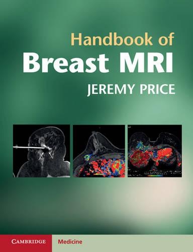 Бумажная книга «Handbook of Breast MRI», автор Джереми Прайс - фото №1