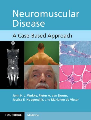Бумажная книга «Neuromuscular Disease: A Case-Based Approach», авторов Джессика Е. Хугендайк, Джон Х. Дж. Вукке, Марианна де Виссер, Питер А. ван Дорн - фото №1
