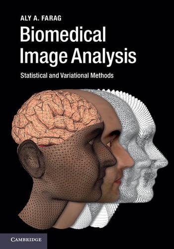 Бумажная книга «Biomedical Image Analysis: Statistical and Variational Methods», автор Али А. Фараг - фото №1