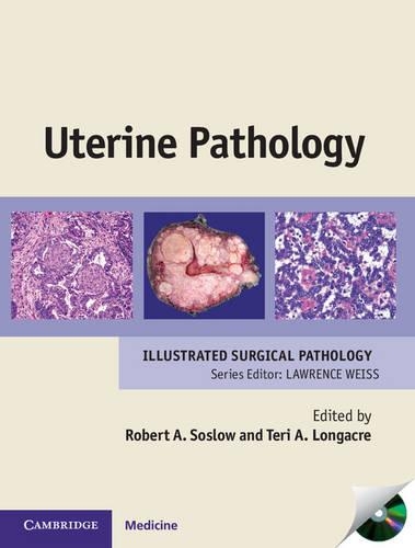 Бумажная книга «Uterine Pathology», автор Роберт А. Сослоу - фото №1