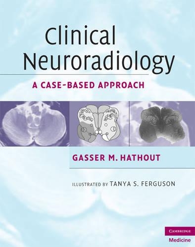 Паперова книга «Clinical Neuroradiology: A Case-Based Approach», автор Гассер М. Хатхаут - фото №1