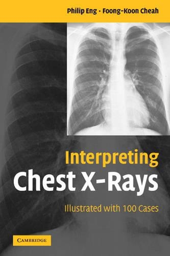 Паперова книга «Interpreting Chest X-Rays: Illustrated with 100 Cases», авторів Фун-Кун Чеа, Філіп Енг - фото №1