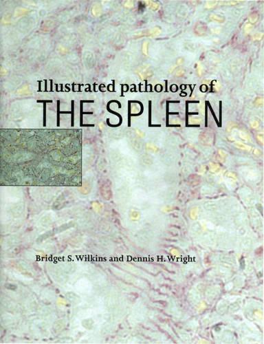 Бумажная книга «Illustrated Pathology of the Spleen», автор Бриджет С. Уилкинс - фото №1
