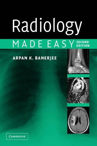 Паперова книга «Radiology Made Easy», автор Арпан К. Банерджі - фото №1
