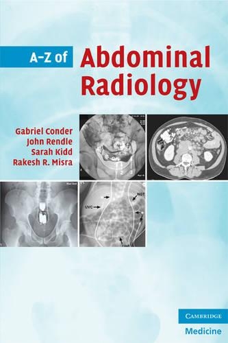 Паперова книга «A-Z of Abdominal Radiology», авторів Габріель Кондер, Джон Рендл, Ракеш Р. Місра, Сара Кідд - фото №1