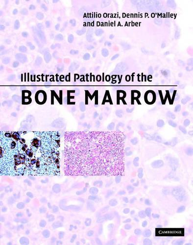 Паперова книга «Illustrated Pathology of the Bone Marrow», авторів Аттіліо Оразі, Даніель А. Арбер, Денніс П. О'Меллі - фото №1
