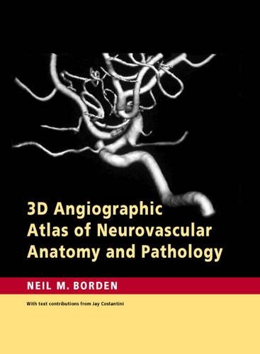 Бумажная книга «3D Angiographic Atlas of Neurovascular Anatomy and Pathology», автор Нил М. Борден - фото №1