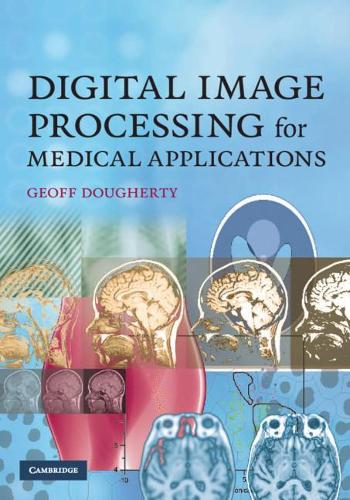 Бумажная книга «Digital Image Processing for Medical Applications», автор Джефф Догерти - фото №1