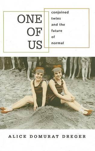 Бумажная книга «One of Us: Conjoined Twins and the Future of Normal», автор Алиса Домурат Дрегер - фото №1