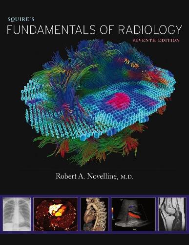 Бумажная книга «Squire’s Fundamentals of Radiology: Seventh Edition», автор Роберт А. Новеллин - фото №1