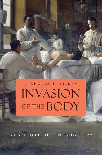 Бумажная книга «Invasion of the Body: Revolutions in Surgery», автор Николас Л. Тилни - фото №1