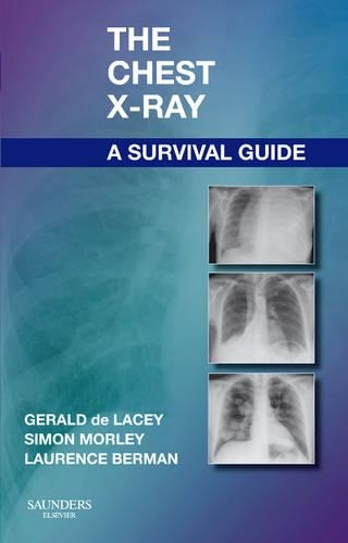 Бумажная книга «The Chest X-Ray: A Survival Guide», авторов Джеральд де Лейси, Лоренс Берман, Саймон Морли - фото №1