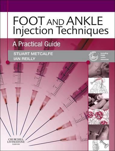 Бумажная книга «Foot and Ankle Injection Techniques: A Practical Guide», авторов Ян Рейли, Стюарт Меткалф - фото №1