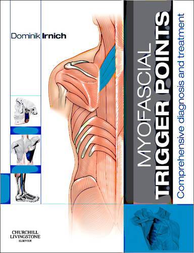 Бумажная книга «Myofascial Trigger Points: Comprehensive diagnosis and treatment», автор Доминик Ирнич - фото №1