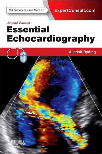 Паперова книга «Essential Echocardiography: Expert Consult - Online & Print», автор Алісдер Райдінг - фото №1