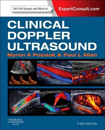 Паперова книга «Clinical Doppler Ultrasound: Expert Consult: Online and Print», авторів Мирон А. Позняк, Пол Л. Аллан - фото №1