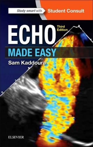 Паперова книга «Echo Made Easy», автор Сем Каддура - фото №1