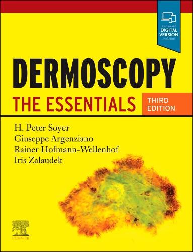 Бумажная книга «Dermoscopy: The Essentials», авторов Джузеппе Аргенциано, Х. Питер Сойер, Айрис Залаудек, Райнер Хофманн-Велленхоф - фото №1