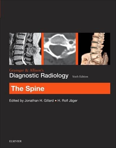Бумажная книга «Grainger & Allison's Diagnostic Radiology: The Spine», авторов Х. Рольф Ягер, Джонатан Гиллард - фото №1