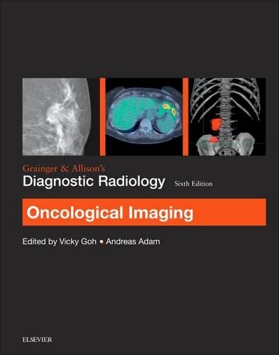 Бумажная книга «Grainger & Allison's Diagnostic Radiology: Oncological Imaging», авторов Энди Адам, Виктория Го - фото №1