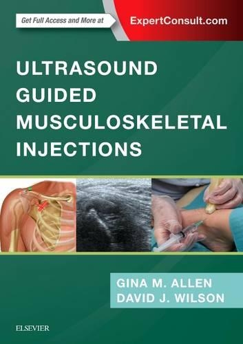 Паперова книга «Ultrasound Guided Musculoskeletal Injections», авторів Девід Джон Вілсон, Джина М Аллен - фото №1