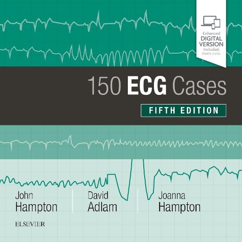 Паперова книга «150 ECG Cases», авторів Девід Адлам, Джоанна Гемптон, Джон Гемптон - фото №1