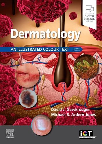 Паперова книга «Dermatology: An Illustrated Colour Text», авторів Девід Гавкроджер, Майкл Р. Ардерн-Джонс - фото №1