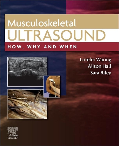 Бумажная книга «Musculoskeletal Ultrasound: How, Why and When», авторов Элисон Холл, Лорелея Уоринг, Сара Райли - фото №1