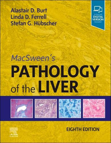 Паперова книга «MacSween's Pathology of the Liver», авторів Аластер Д. Берт, Лінда Д. Феррелл, Стефан Г. Хюбшер - фото №1