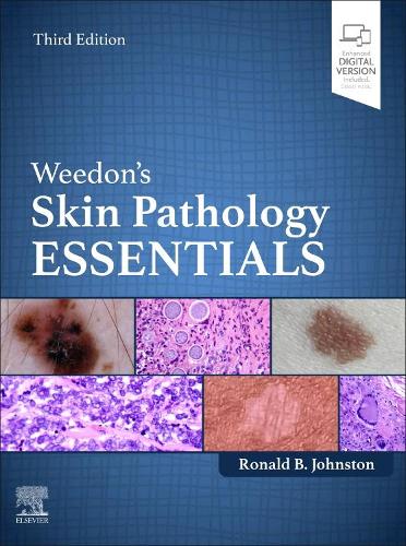 Паперова книга «Weedon's Skin Pathology Essentials», автор Рональд Джонстон - фото №1
