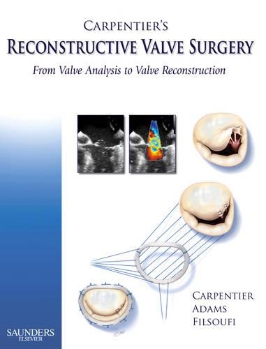 Бумажная книга «Carpentier's Reconstructive Valve Surgery», авторов Ален Карпантье, Дэвид Х. Адамс, Фарзан Фильсуфи - фото №1