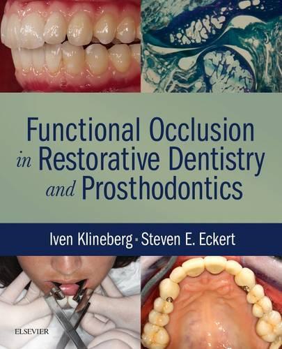 Паперова книга «Functional Occlusion in Restorative Dentistry and Prosthodontics», авторів Івен Клайнберг, Стівен Еккерт - фото №1