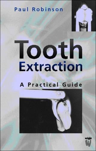 Паперова книга «Tooth Extraction: A Practical Guide», автор Пол Д. Робінсон - фото №1