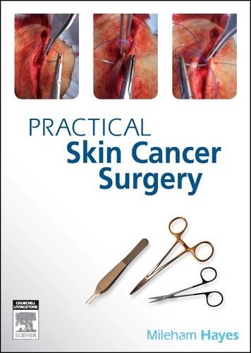 Бумажная книга «Practical Skin Cancer Surgery», автор Милехем Хейс - фото №1